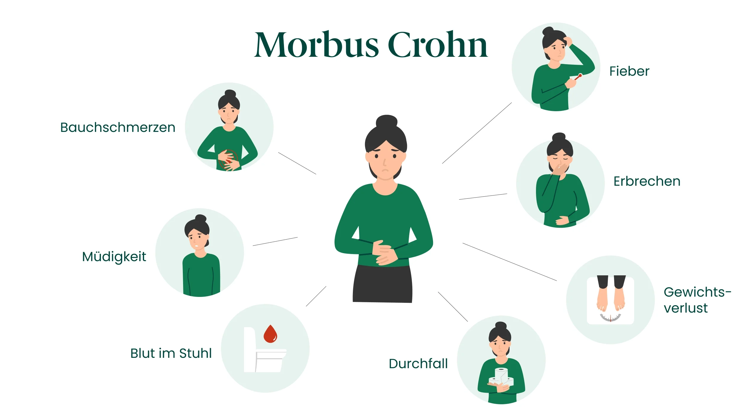 Abbildung zu Symptomen bei Morbus Crohn