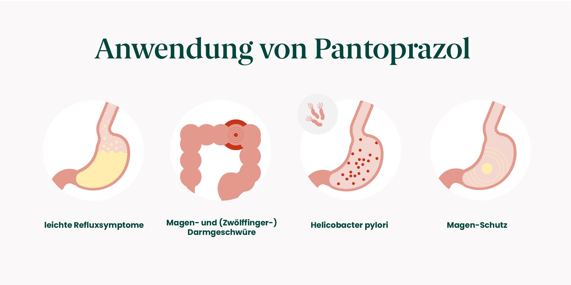 Anwendung von Pantoprazol