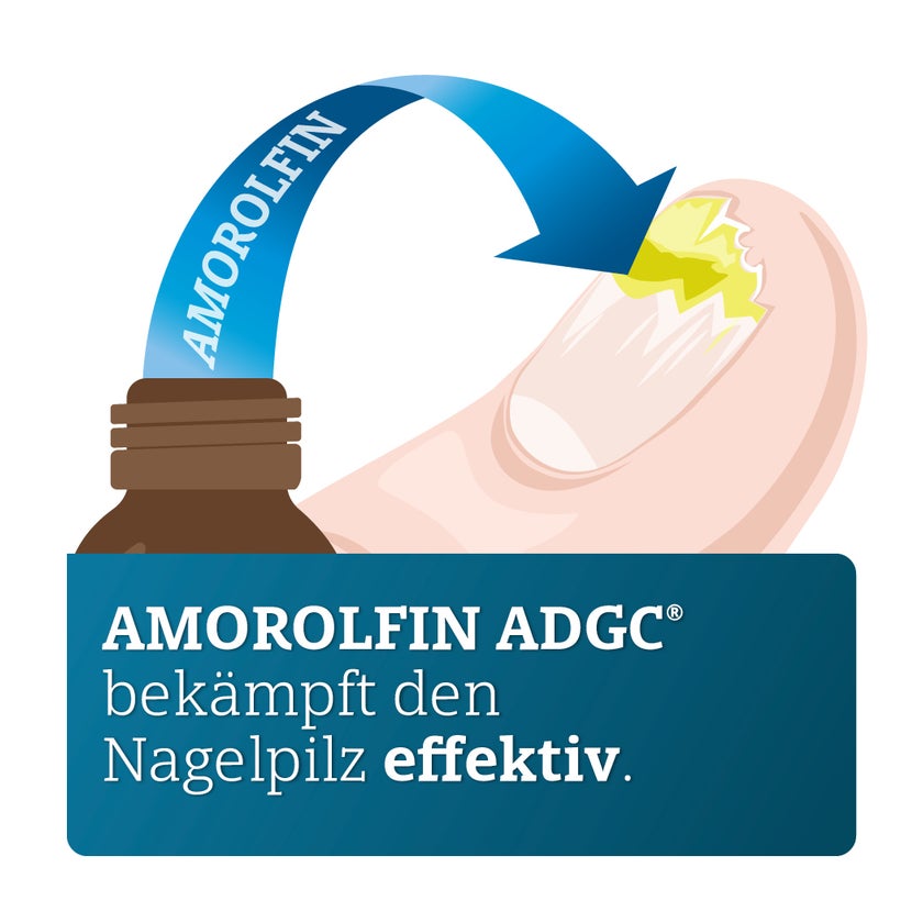 AMOROLFIN ADGC 50 mg/ml wirkstoffhalt. Nagellack 5 ml
