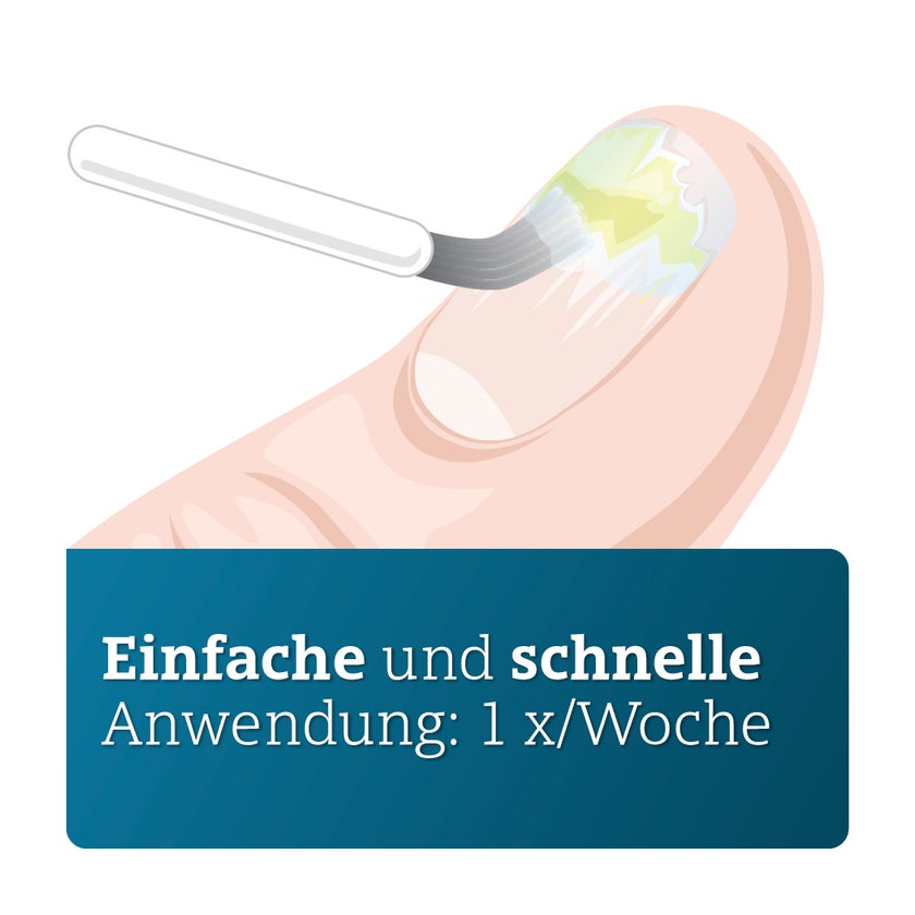 AMOROLFIN ADGC 50 mg/ml wirkstoffhalt. Nagellack 5 ml