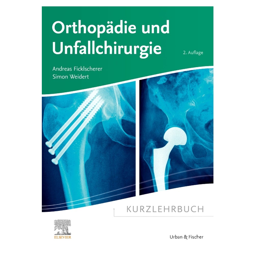 Kurzlehrbuch Orthopädie und Unfallchirurgie 1 St