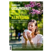 Spektrum Gesundheit - Allergien