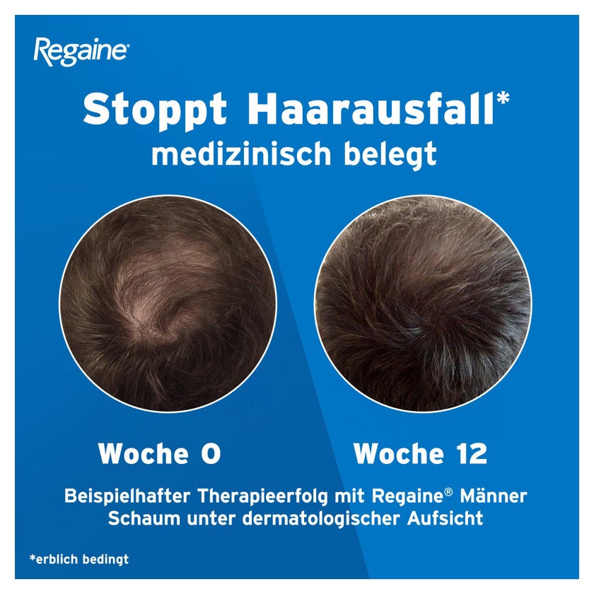 Regaine Männer Schaum mit Minoxidil 3X60 ml