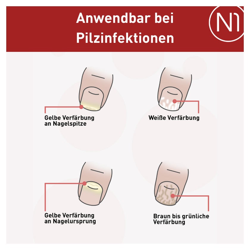 N1 Nagelpilz Lösung 10 ml