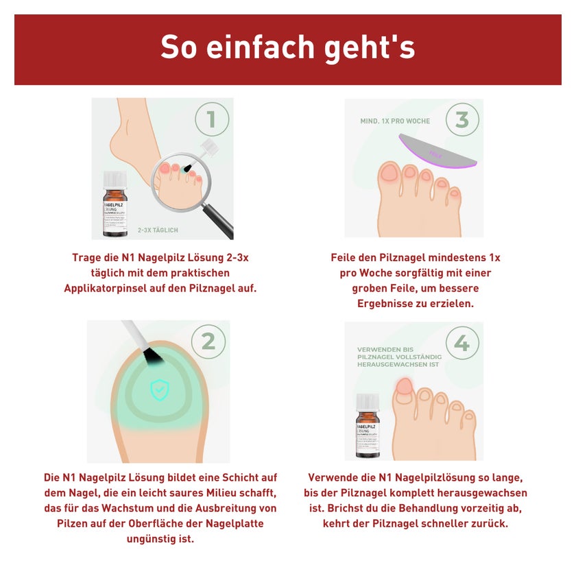 N1 Nagelpilz Lösung 10 ml