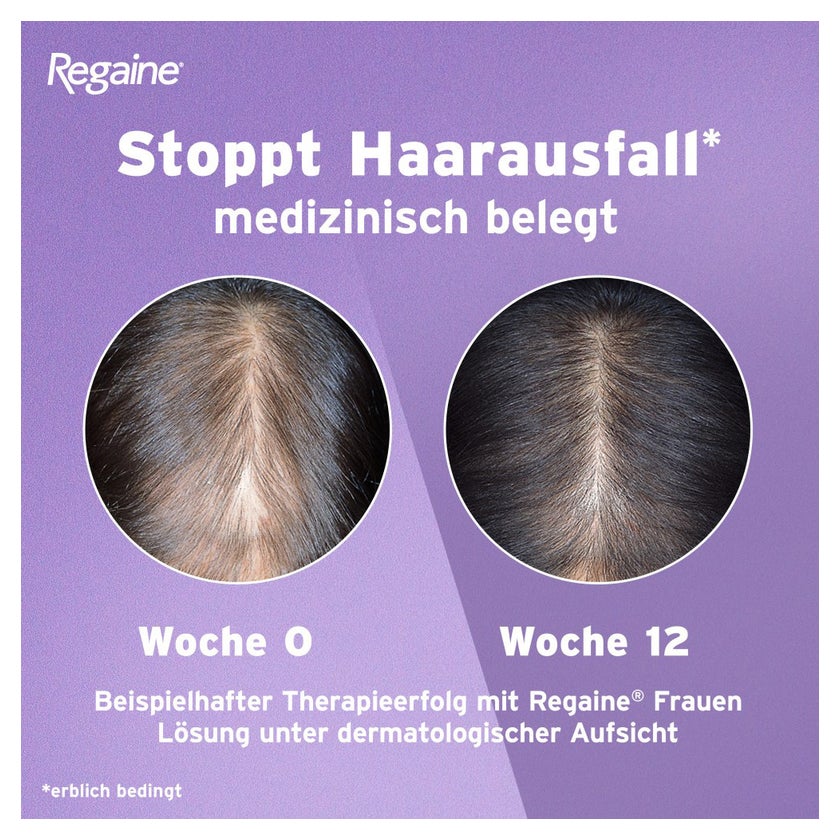 Regaine Frauen Lösung mit Minoxidil 3X60 ml