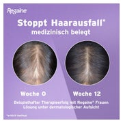 Regaine Frauen Lösung mit Minoxidil 3X60 ml