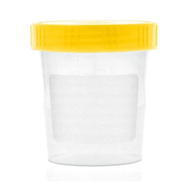 10x Urinbecher/Probenbecher mit Schraubdeckel - 125ml 10 St