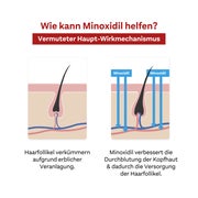 MINOXIDIL DoppelherzPharma 50 mg/ml Lösung 3X60 ml