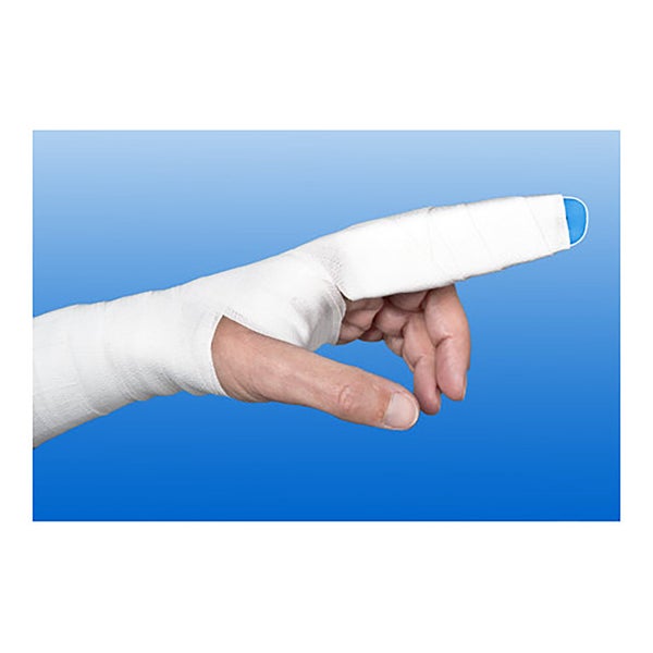 NOBA Nobarigid® Aluminium Fingerschiene - 1,2 cm x 48 cm 1 St