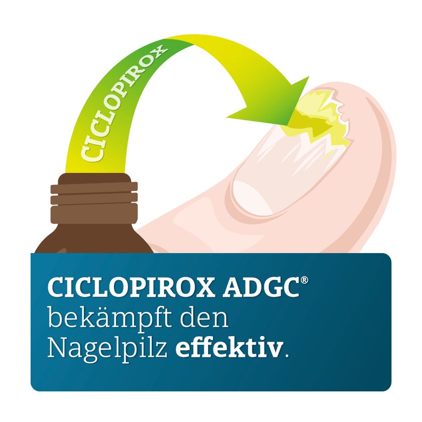 Ciclopirox ADGC 80 mg/g 6,6 ml