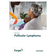 Fast Facts: Follicular Lymphoma 1 St