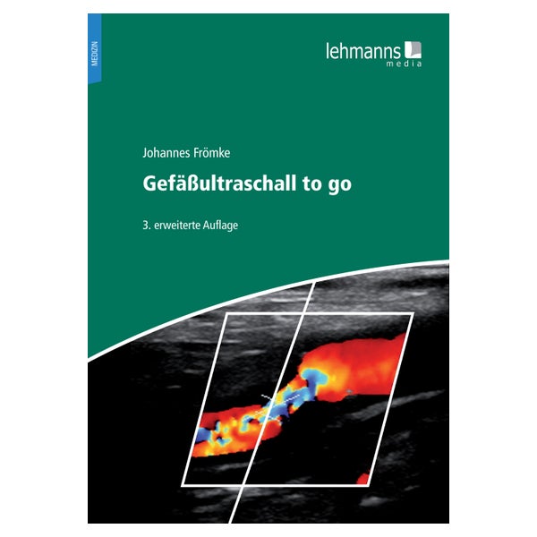 Gefäßultraschall to go 1 St